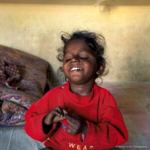 A young child who is blind in Janta Colony.