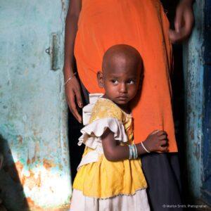 A young girl with tuberculosis clings to her mother's legs.