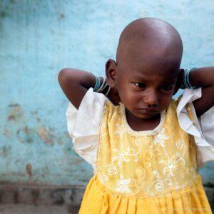 A young girl with TB is isolated from friends.